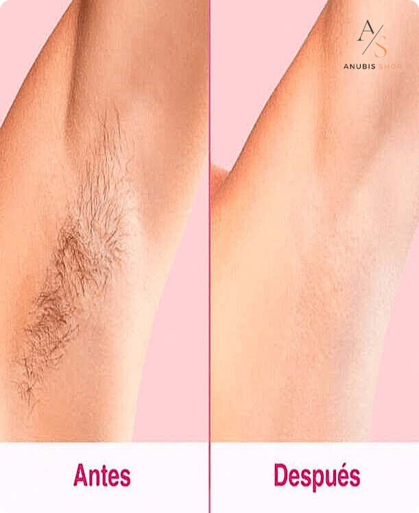 Depiladora Laser IPL PRO™